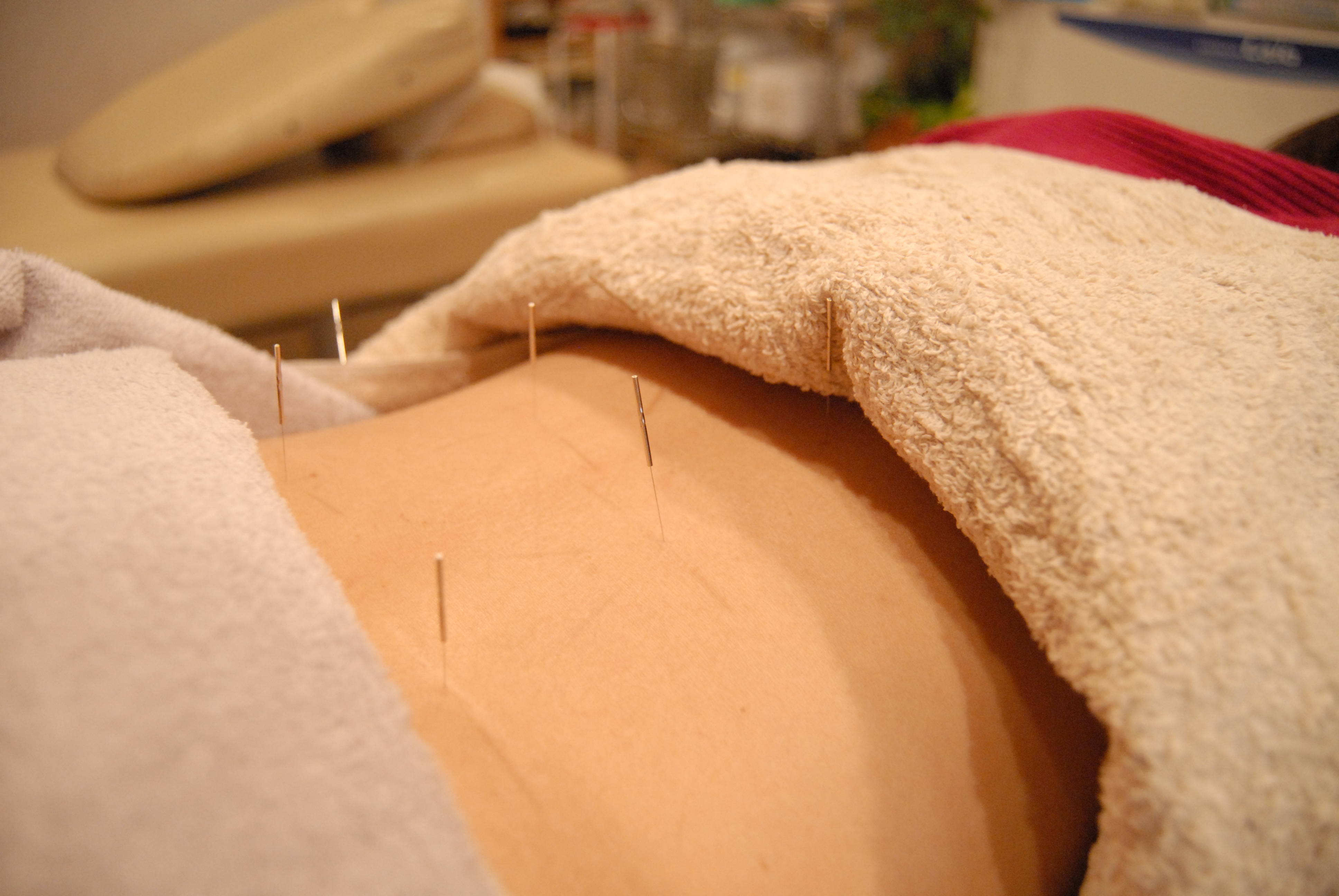 糀谷駅前鍼灸整骨院